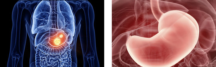 Application of Trioctyl trimellitate (TOTM) CAS 3319-31-1